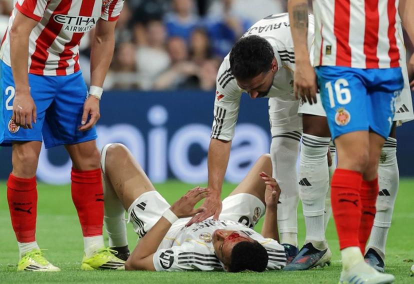 Real Madrid's Spanish defender #02 Dani Carvajal checks on Real Madrid's French forward #10 Kylian Mbappe (BOTTOM) who lies on the pitch with blood on his face after colliding with Girona's Brazilian defender #12 Vitor Reis (not pictured) during the Spanish league football match between Real Madrid CF and Girona FC at the Santiago Bernabeu stadium in Madrid on April 10, 2026. Thomas COEX / AFP